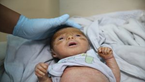 Balık pulu hastası 18 günlük Mutaz tedavi için Türkiye'ye getirildi