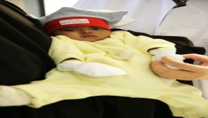 4 bacaklı doğan Somalili "parazitik yapışık ikiz", şifayı Türkiye'de buldu