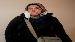 Maltepe'de yolda yürürken bir kişinin saldırısına uğrayan kadın yaralandı