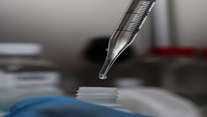 TÜBİTAK desteğiyle geliştirilen kit Kovid-19'u 10 dakikadan kısa sürede saptayacak