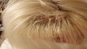 Kocaeli'de boyattıktan sonra saçları dökülen kadın avukat, kuaförden şikayetçi oldu