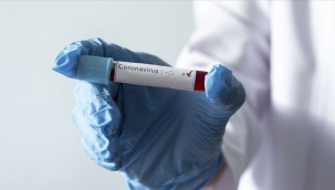 10 Şubat 2021 korona virüs tablosu: 95 can kaybı, 6 bin 642 yeni vaka