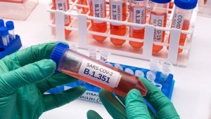 Kayseri İl Sağlık Müdürü Benli, "Kayseri'de 2 delta varyantı görüldü!"