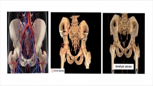 Trabzon'da leğen kemiğinde 7 kırık olan hasta, ameliyatla sağlığına kavuştu