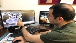 Zonguldak'ta kulak kemiğinde tümör bulunan hasta 11 saatlik operasyonla sağlığına kavuştu