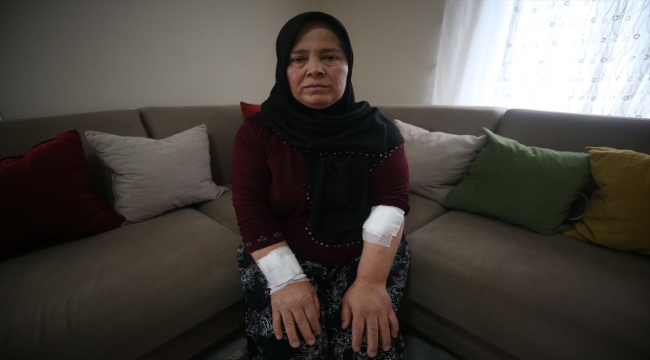 Düzce'de pitbull saldırısında yaralanan kadın yaşadıklarını unutamıyor 