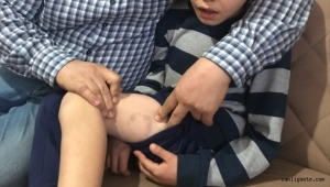 Kayseri'de köpeklerin saldırısında yaralanan çocuk olay anını anlattı