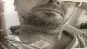 Arkadaşının boğazını kesen sanığa "canavarca hisle öldürmeye teşebbüsten" dava