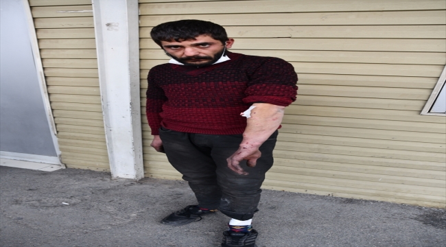 Gaziantep'te pitbull cinsi köpeğin saldırdığı kişi yaralandı