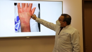 Türk bilim insanlarının çalışması, ABD merkezli dergide yayımlandı