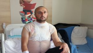 Erzurum'da banyo yaparken başından döktüğü kaynar suyla yanan vatandaşın tedavisi sürüyor 