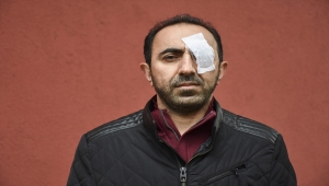 Kameramanın kornea nakli yapılan gözüne yumruk atıldığı kavgaya ilişkin 6 kişiye dava