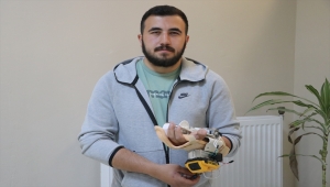 Üniversite öğrencisi tendon tedavisine destek için otonom protez tasarladı