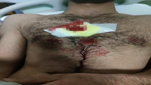 Yunanistan, sınırı geçmeye çalışan düzensiz göçmenlere karşı plastik mermi kullandı
