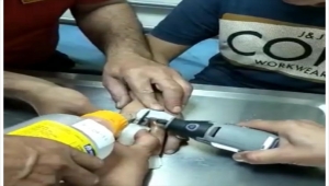 Kırıkkale'de çocuğun parmağına sıkışan metal somunu itfaiye çıkardı