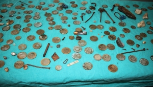 Midesinden 233 parça yabancı cisim çıkarılan hasta sağlığına kavuştu